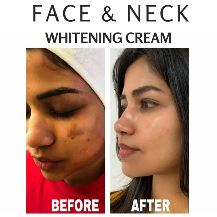 FACE & NECK WHITENING CREAM (PREMIUM QUALITY )